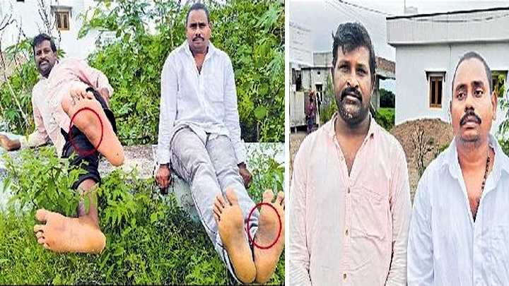 బాపట్లలో దళిత యువకులపై సీఐ అమానుష దాడి