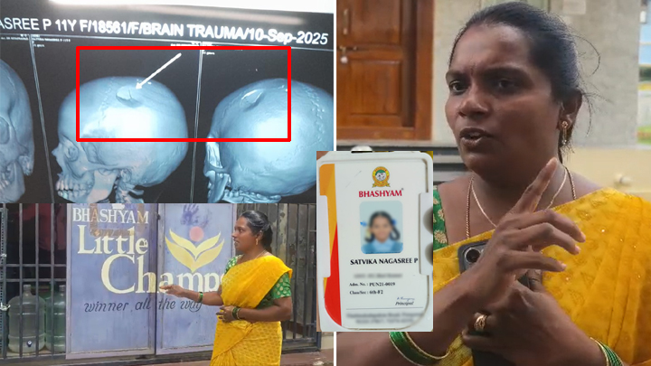 భాష్యం స్కూల్లో దారుణం.. విద్యార్థిని తల పగలగొట్టిన టీచర్