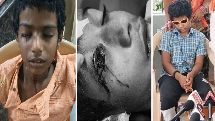 ఫీజు కట్టలేదనే విద్యార్థిపై దాడి.. చూపు కోల్పోయిన బాలుడు