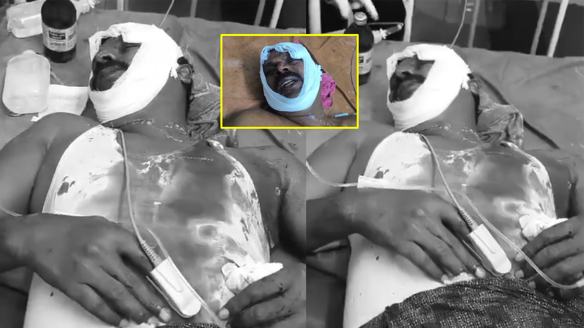 వైసీపీ నేత‌పై మంత్రి అనుచ‌రుల‌ హింసాత్మక దాడి