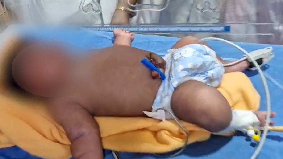 భద్రాచలంలో అద్భుతం.. ‘బాలభీముడు’ జననం