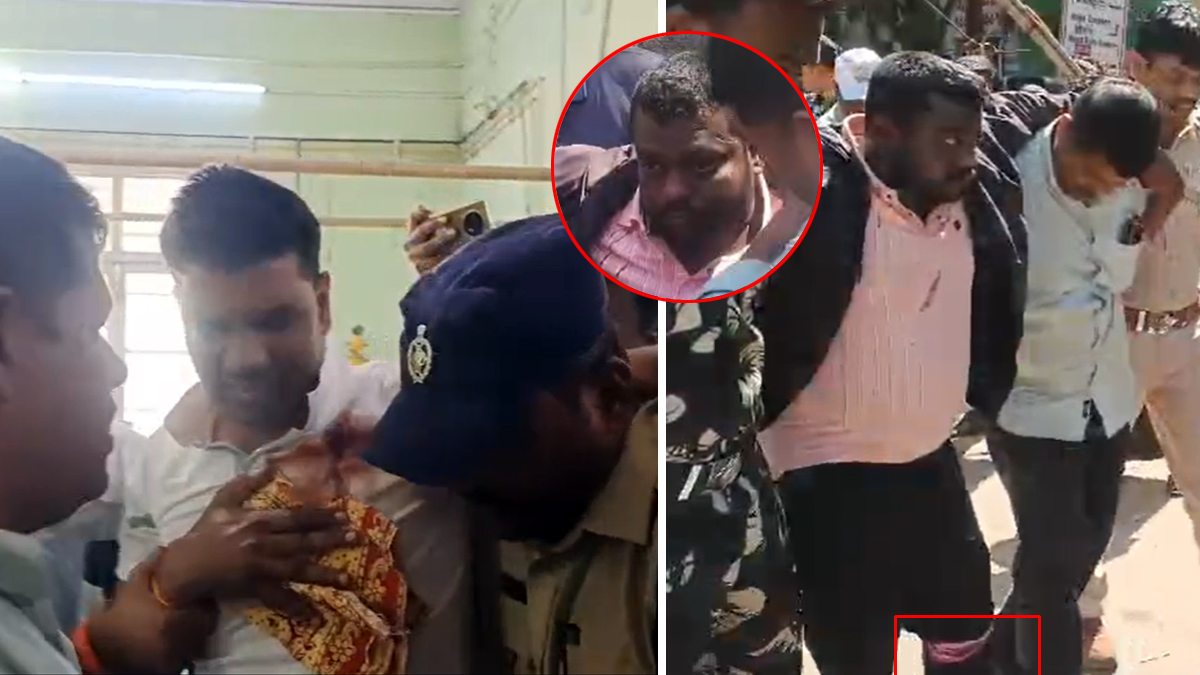 బాలకృష్ణ ఇలాకాలో కాల్పుల కలకలం.. రౌడీషీటర్ కాలికి బుల్లెట్