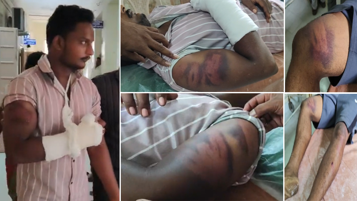 ఎస్ఐ అరాచకం.. యువకుడిపై విచక్షణారహితంగా దాడి!